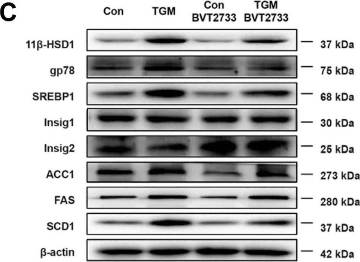 Detection of 11 beta-HSD1 by Western Blot