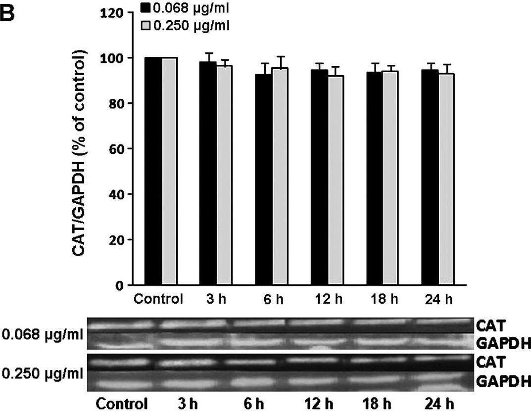 Detection of Catalase by Western Blot