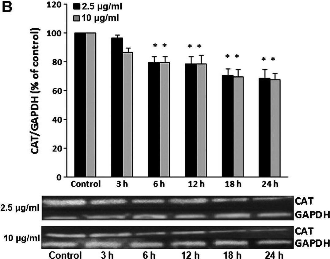 Detection of Catalase by Western Blot