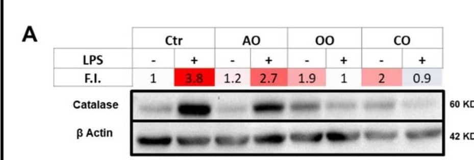 Detection of Catalase by Western Blot
