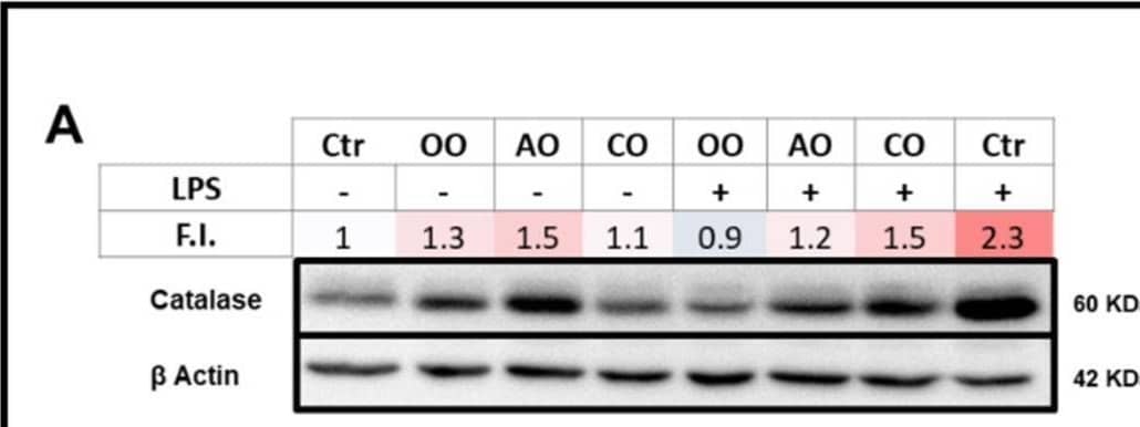Detection of Catalase by Western Blot