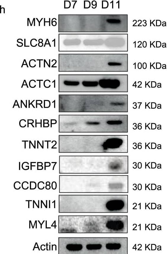 Detection of URB by Western Blot