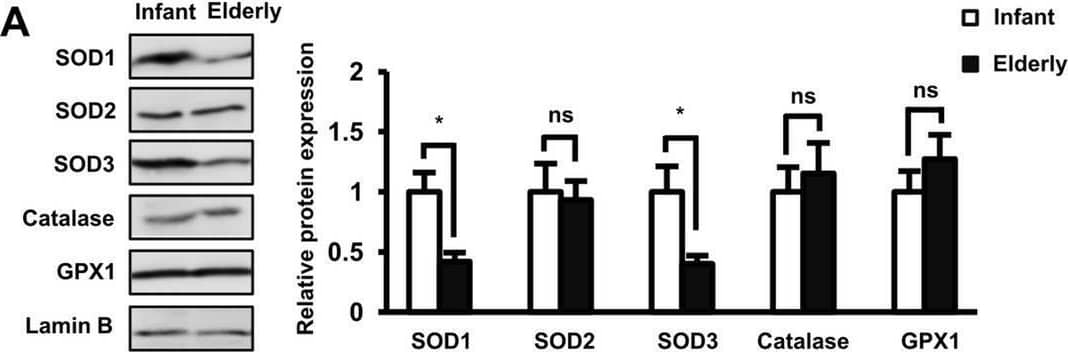 Detection of SOD1/Cu-Zn SOD by Western Blot