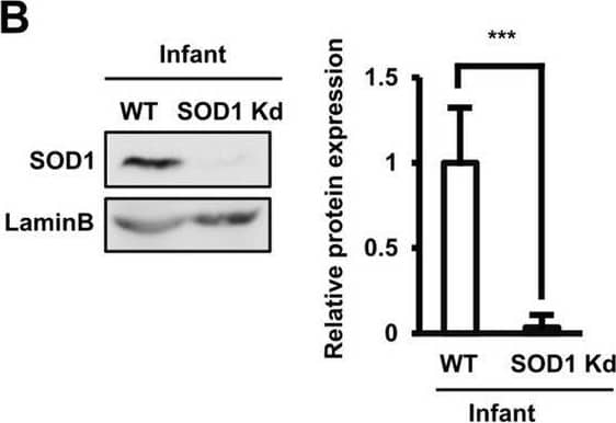 Detection of SOD1/Cu-Zn SOD by Western Blot
