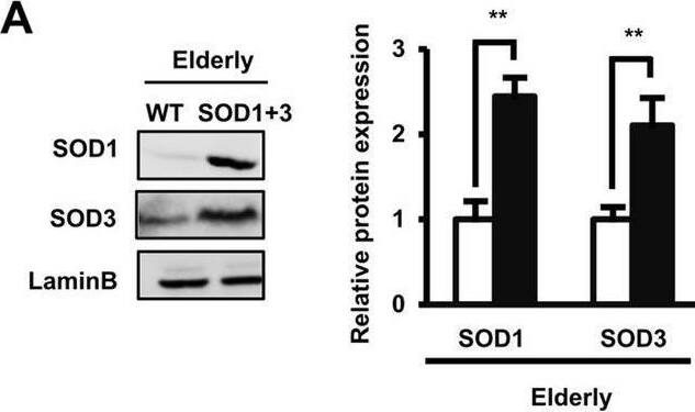 Detection of SOD1/Cu-Zn SOD by Western Blot