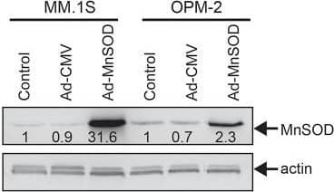 Detection of Mouse SOD2/Mn-SOD by Western Blot