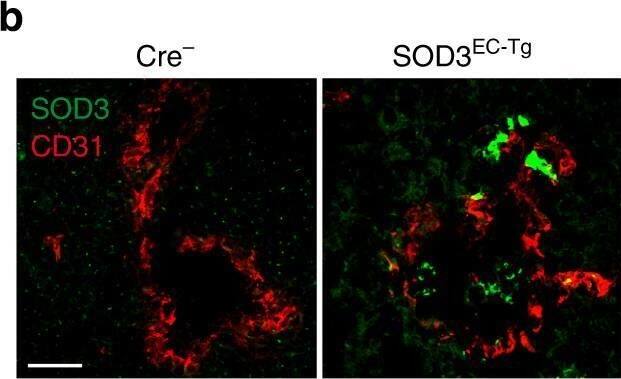 Detection of Mouse SOD3/EC-SOD by Immunohistochemistry