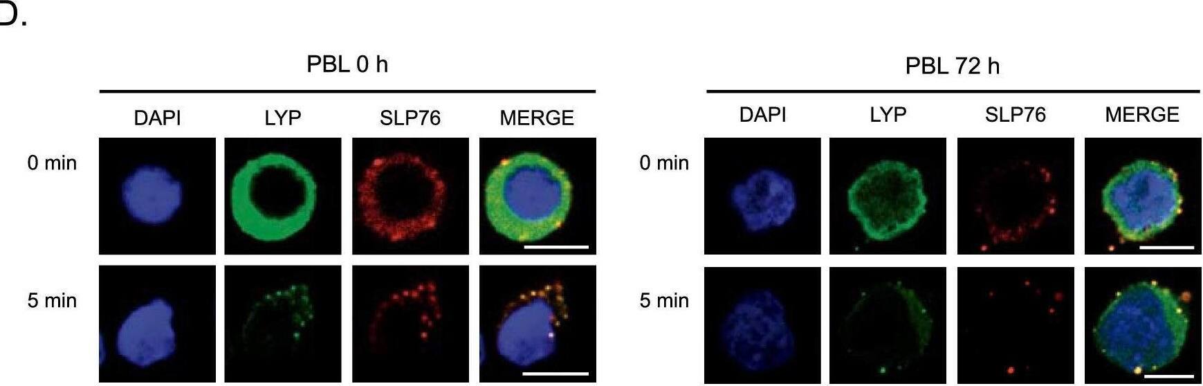 Detection of Human Lyp by Immunocytochemistry/ Immunofluorescence