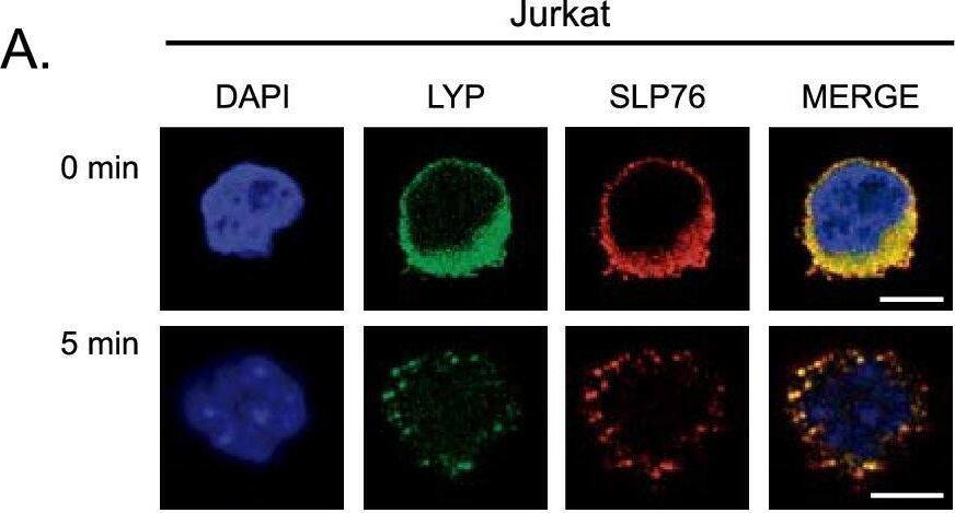 Detection of Human Lyp by Immunocytochemistry/ Immunofluorescence