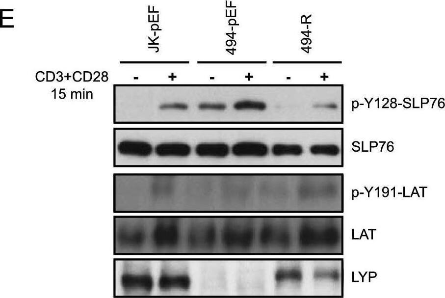 Detection of Human Lyp by Western Blot