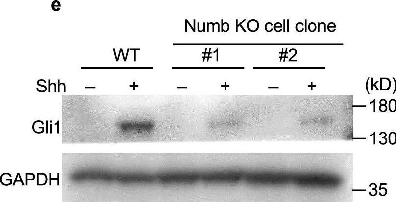 Detection of GLI-1 by Western Blot