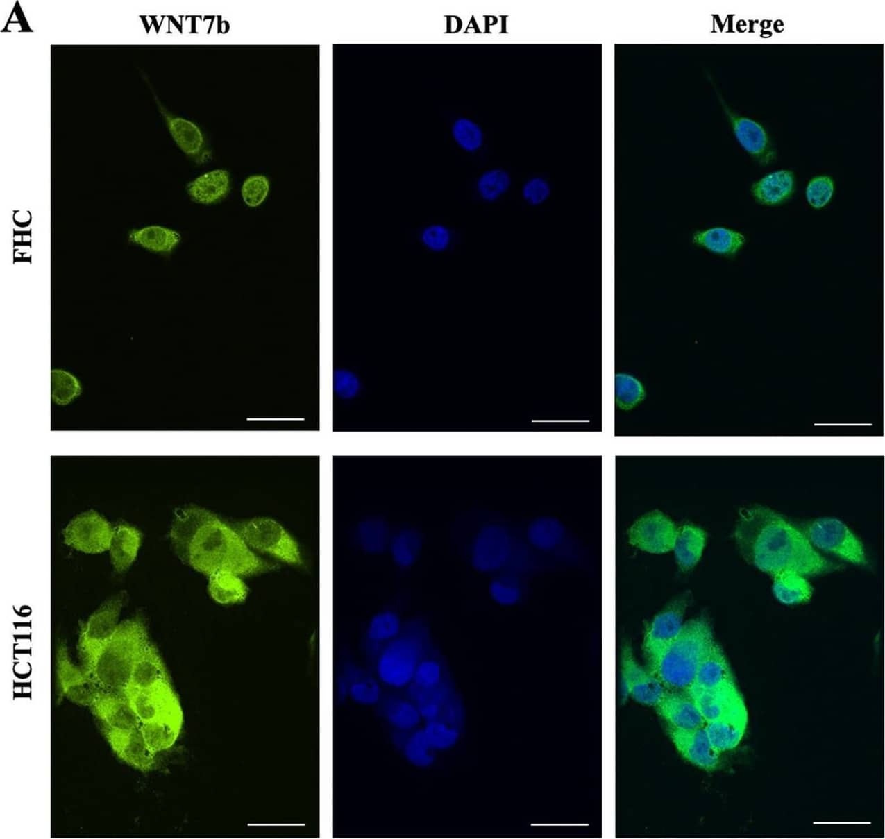 Detection of Wnt-7b by Immunocytochemistry/ Immunofluorescence