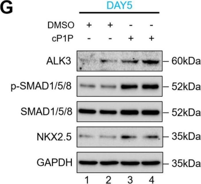 Detection of Human BMPR-IA/ALK-3 by Western Blot