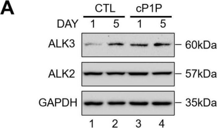 Detection of Human BMPR-IA/ALK-3 by Western Blot