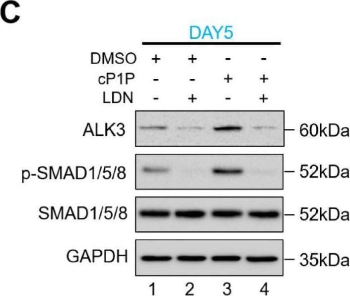 Detection of Human BMPR-IA/ALK-3 by Western Blot