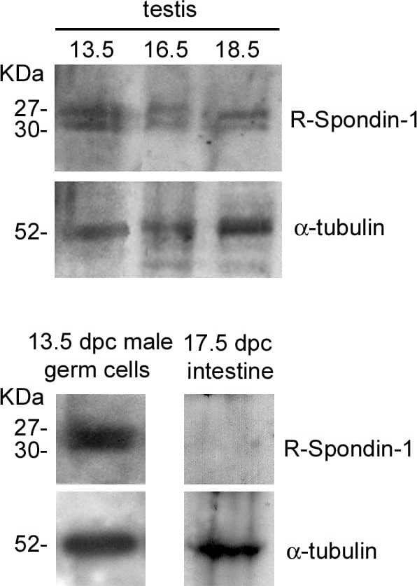 Detection of Mouse R-Spondin 1 by Western Blot