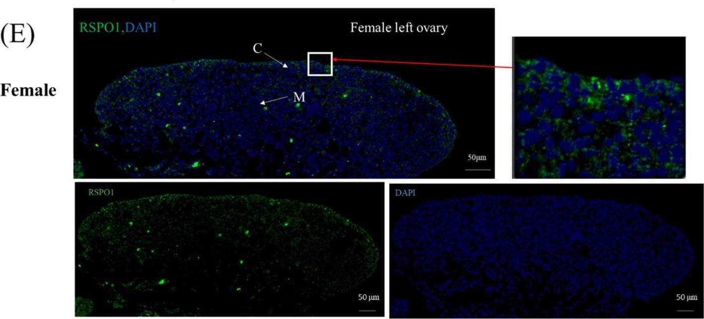 Detection of R-Spondin 1 by Immunohistochemistry