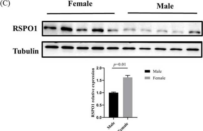 Detection of R-Spondin 1 by Western Blot