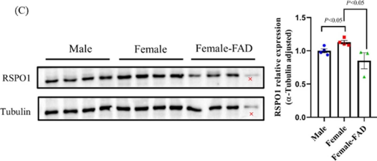Detection of R-Spondin 1 by Western Blot