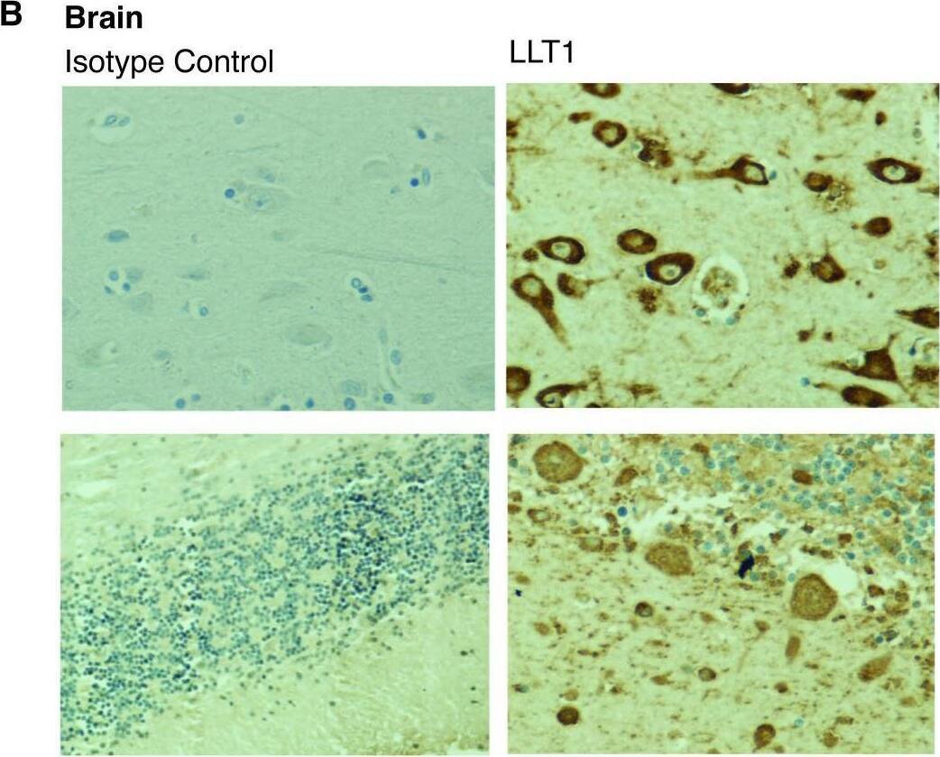 Detection of OCIL/CLEC2d by Immunohistochemistry