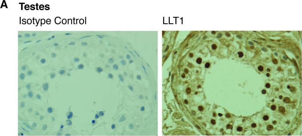 Detection of OCIL/CLEC2d by Immunohistochemistry