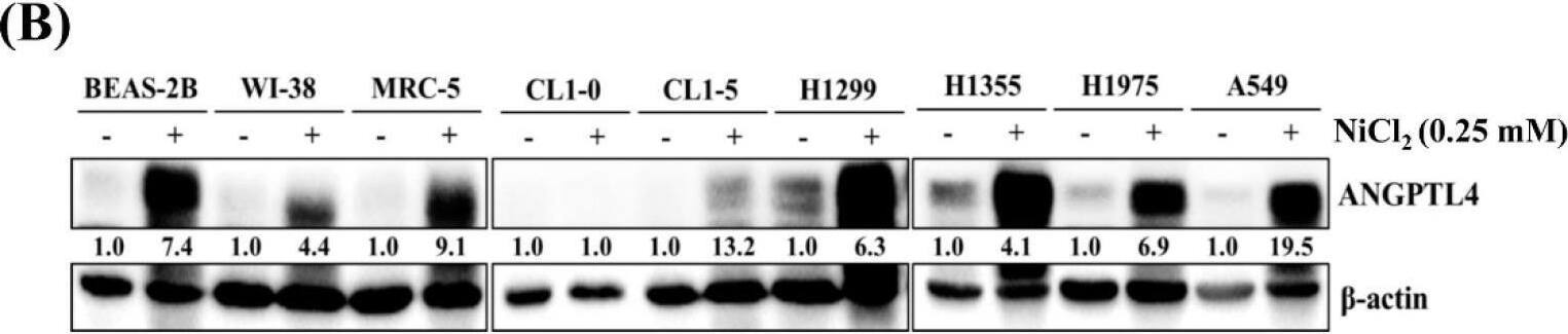 Detection of Angiopoietin-like Protein 4/ANGPTL4 by Western Blot