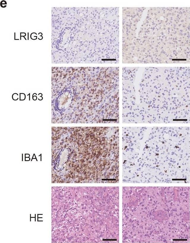 Detection of LRIG3 by Immunohistochemistry