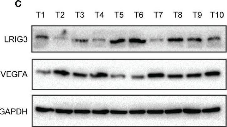 Detection of LRIG3 by Western Blot