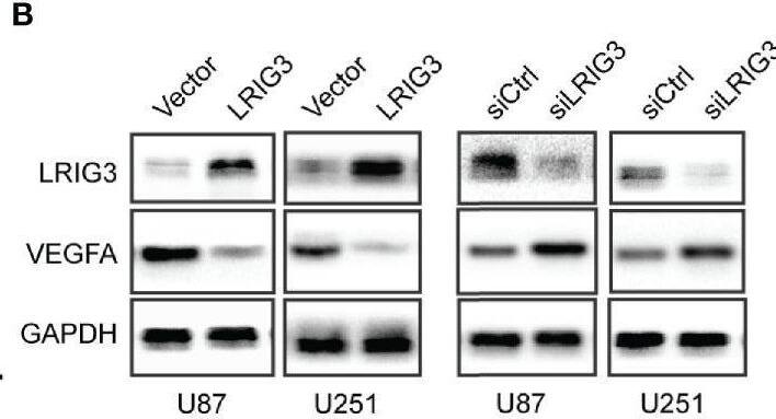 Detection of LRIG3 by Western Blot