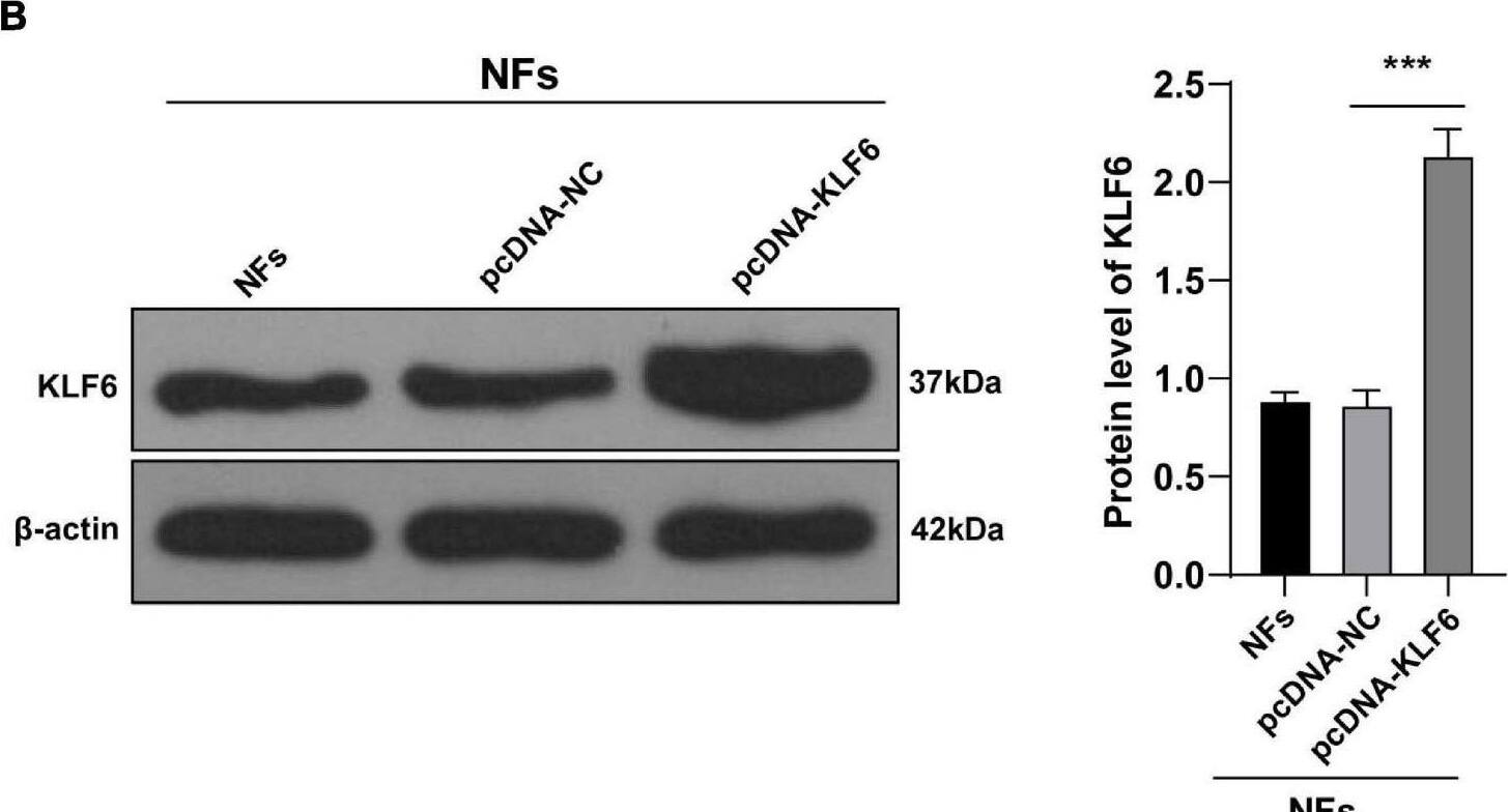 Detection of KLF6 by Western Blot