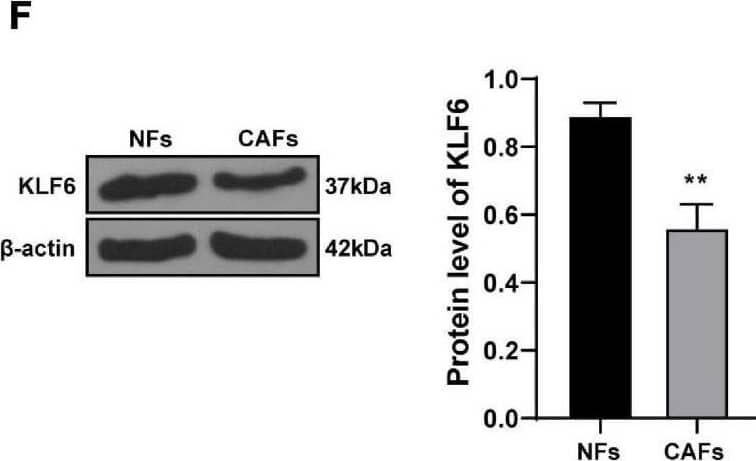 Detection of KLF6 by Western Blot
