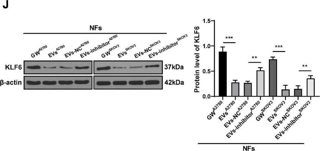 Detection of KLF6 by Western Blot