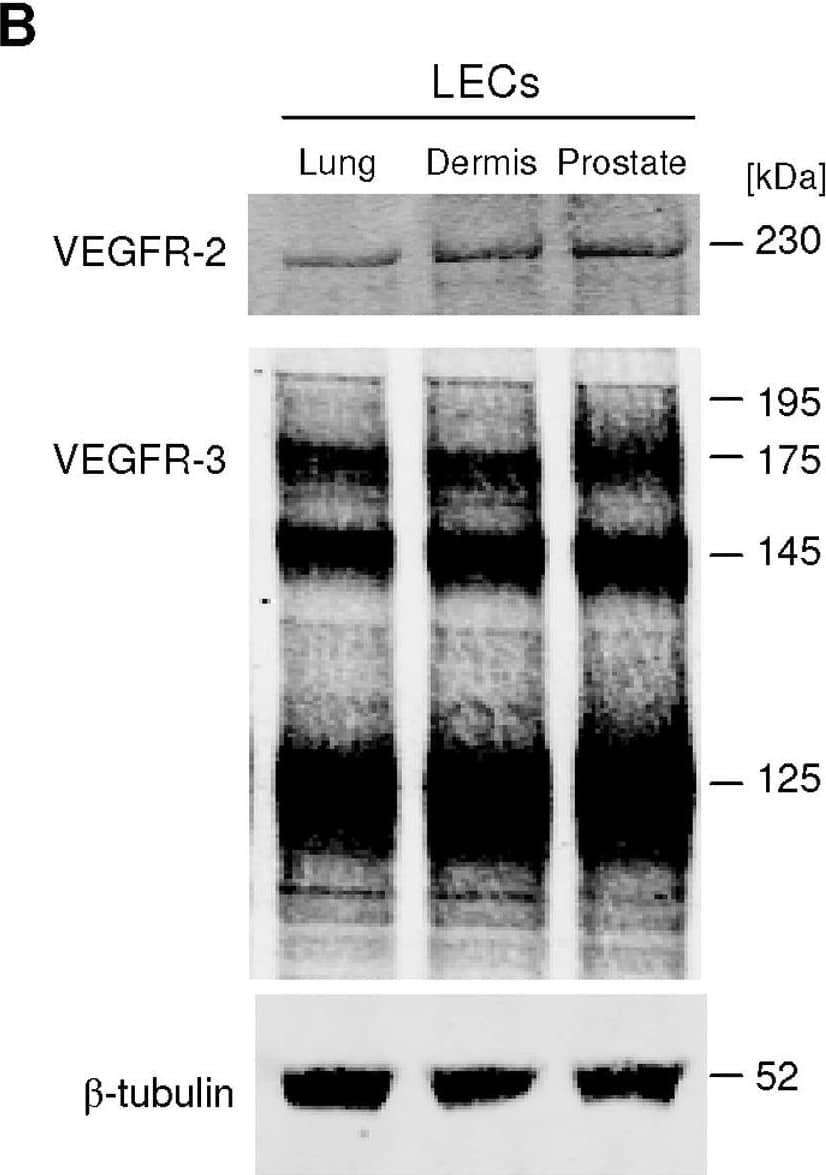 Detection of VEGFR3/Flt-4 by Western Blot