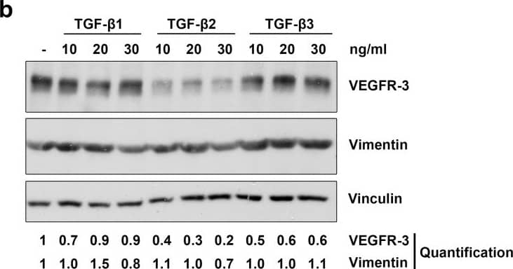 Detection of Human VEGFR3/Flt-4 by Western Blot