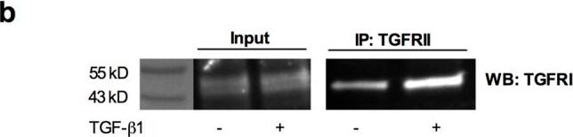 Detection of Mouse MSP/MST1 by Immunoprecipitation
