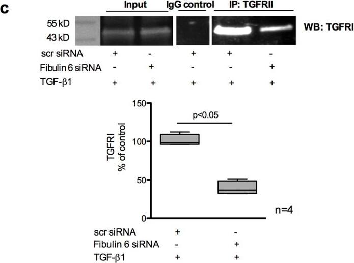 Detection of Mouse MSP/MST1 by Immunoprecipitation