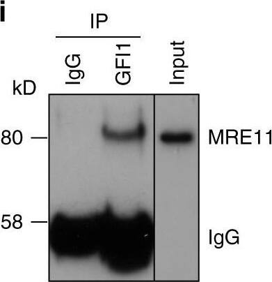 Detection of Human Human GFI-1 Antibody by Immunoprecipitation