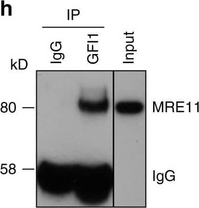 Detection of Human Human GFI-1 Antibody by Immunoprecipitation