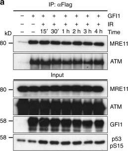 Detection of Human GFI-1 by Western Blot
