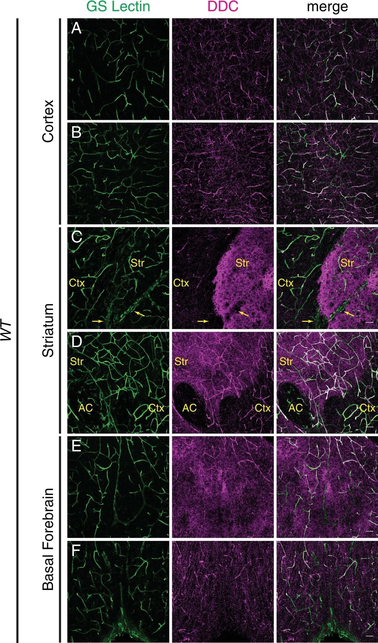 Detection of Mouse Dopa Decarboxylase/DDC by Immunocytochemistry/Immunofluorescence
