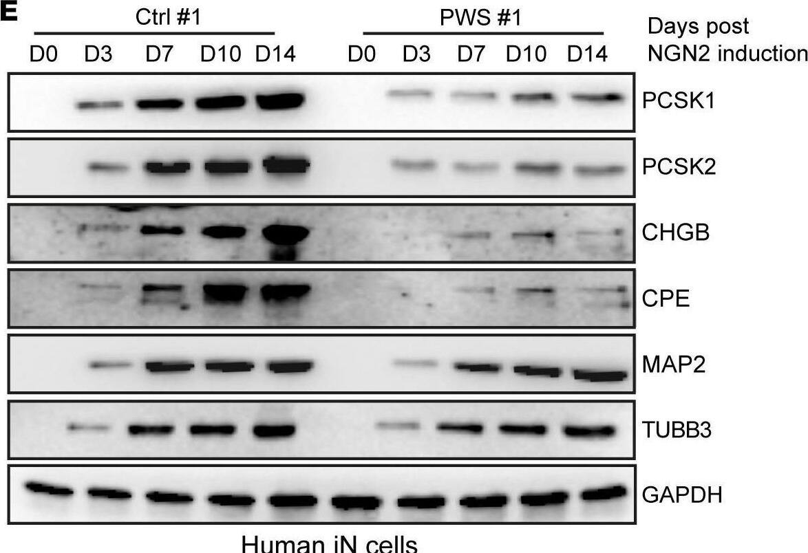 Detection of Carboxypeptidase E/CPE by Western Blot