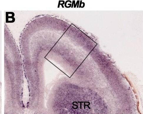 Detection of RGM-B by Immunohistochemistry