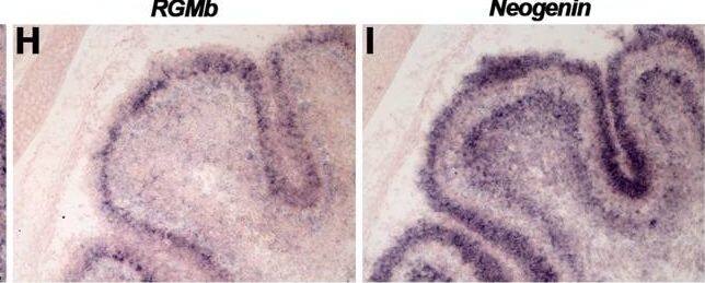 Detection of RGM-B by Immunohistochemistry