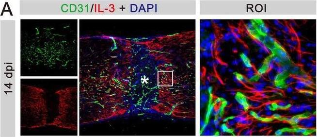 Detection of IL-33 by Immunohistochemistry