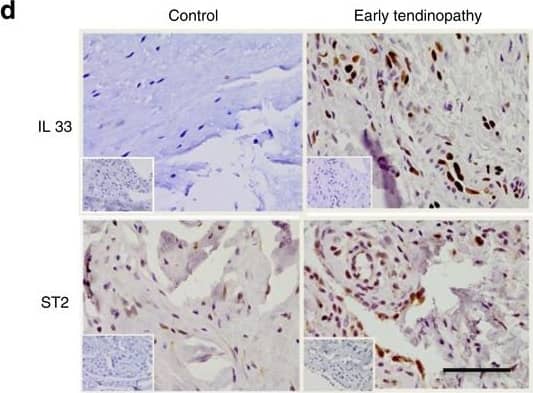 Detection of Human IL-33 by Immunohistochemistry