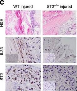 Detection of Mouse IL-33 by Immunohistochemistry