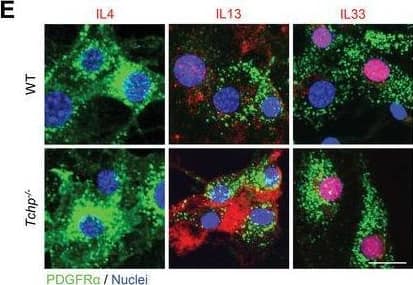 Detection of IL-33 by Immunocytochemistry/ Immunofluorescence