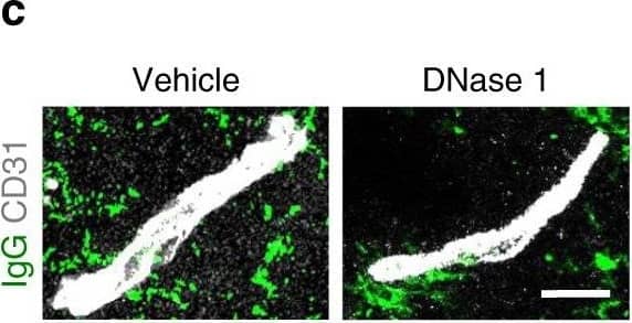 Detection of Mouse Human/Mouse/Rat CD31/PECAM-1 Antibody by Immunohistochemistry