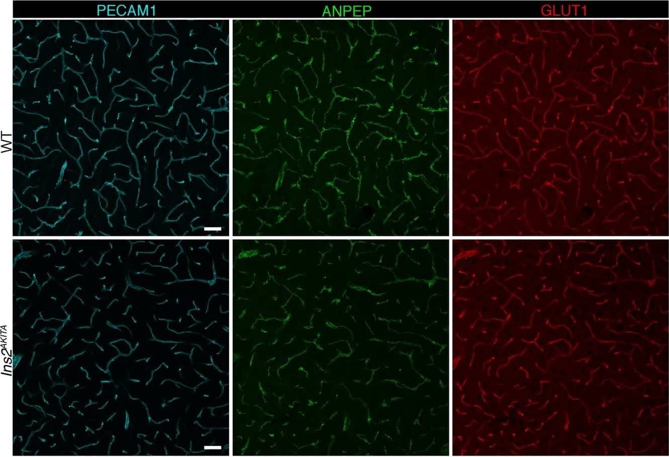 Detection of Mouse CD31/PECAM-1 by Immunohistochemistry
