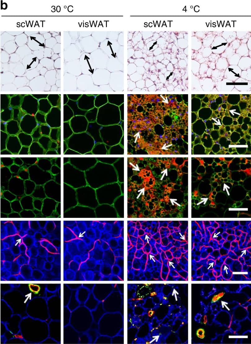 Detection of Mouse CD31/PECAM-1 by Immunocytochemistry/Immunofluorescence